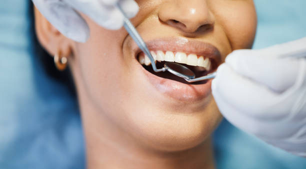 Best Emergency Tooth Extraction in Drexel, NC